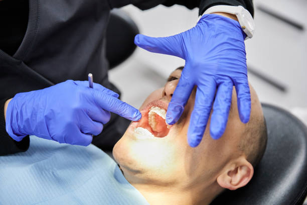 Best Lost Filling or Crown Replacement in Lutcher, LA
