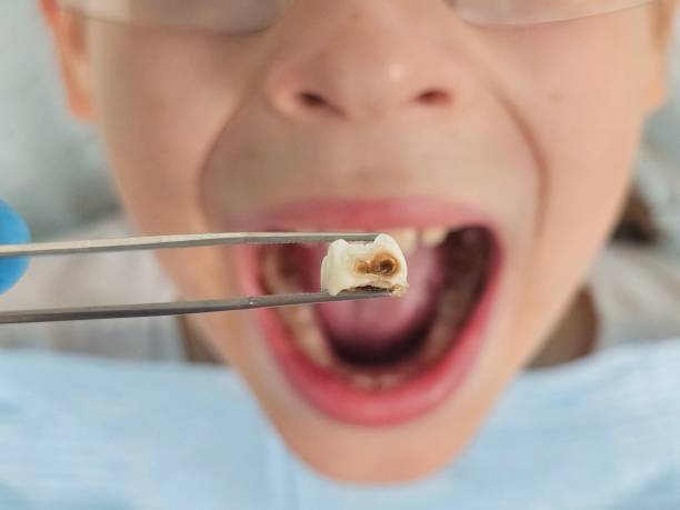 Best Urgent Dental Care for Toothaches in Lutcher, LA